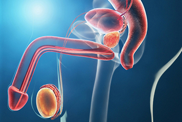 Enfermedad de Peyronie