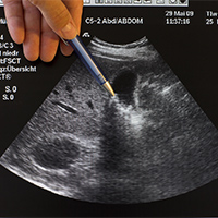 Ecografía Urológica